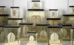 Colezione di cervelli Grant Museum of Zoology ...